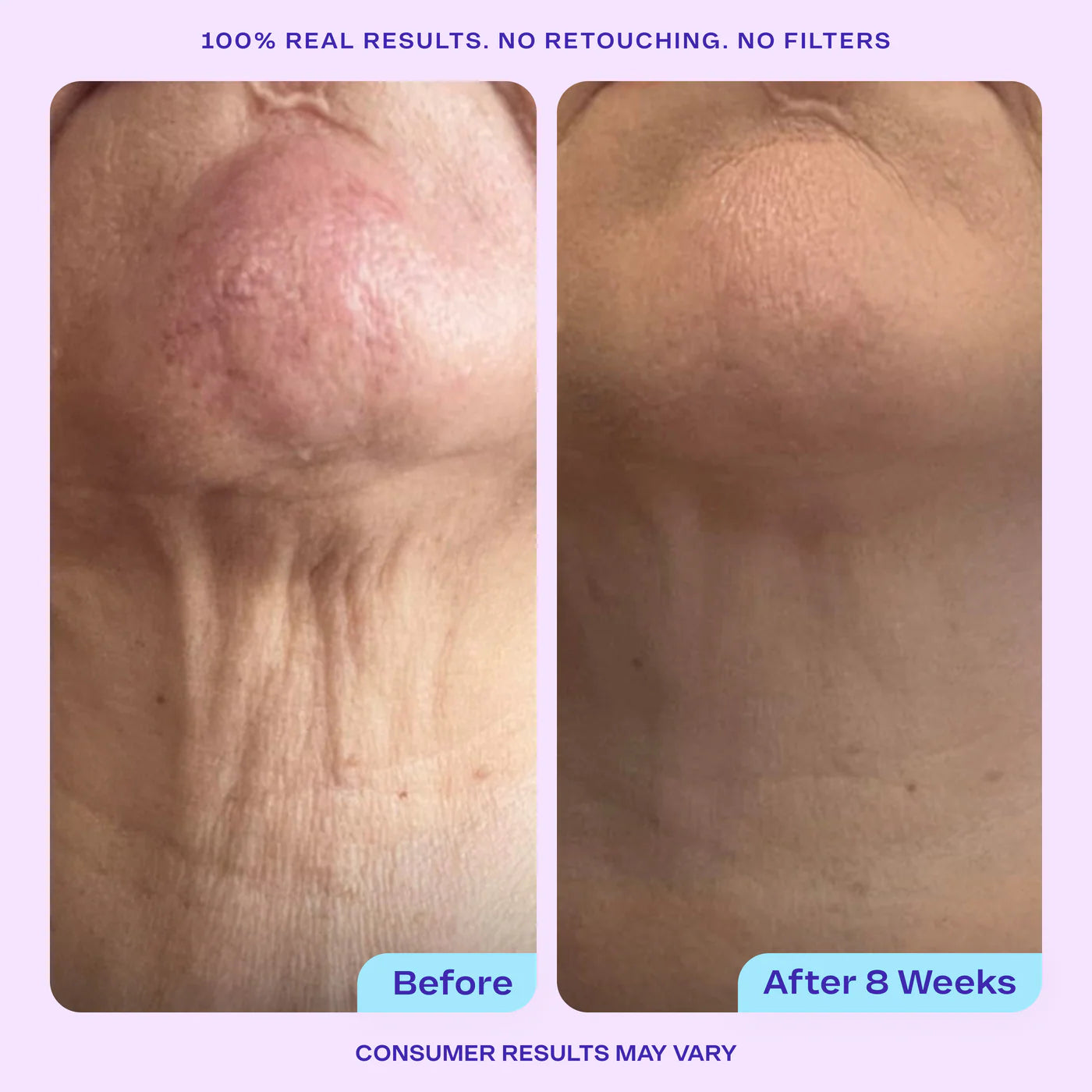 Tighten & Lift Neck Cream