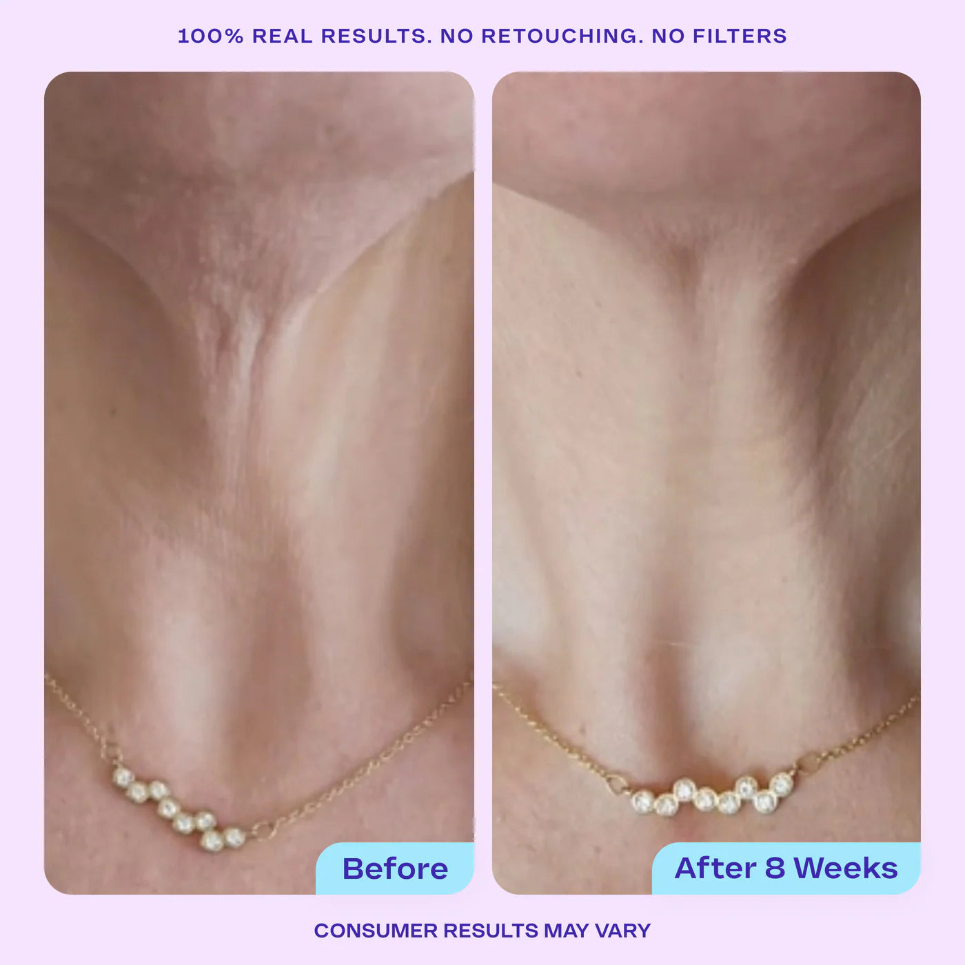 Tighten & Lift Neck Cream