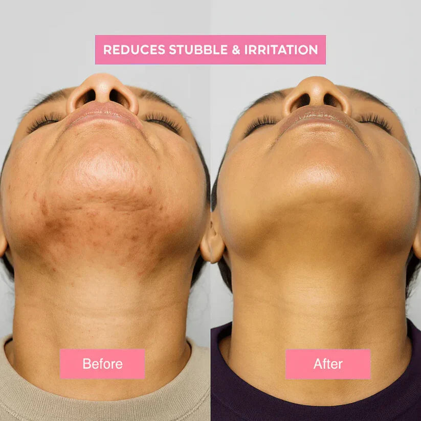 Valeriz Beauty™ Cyperus Rotundus Oil