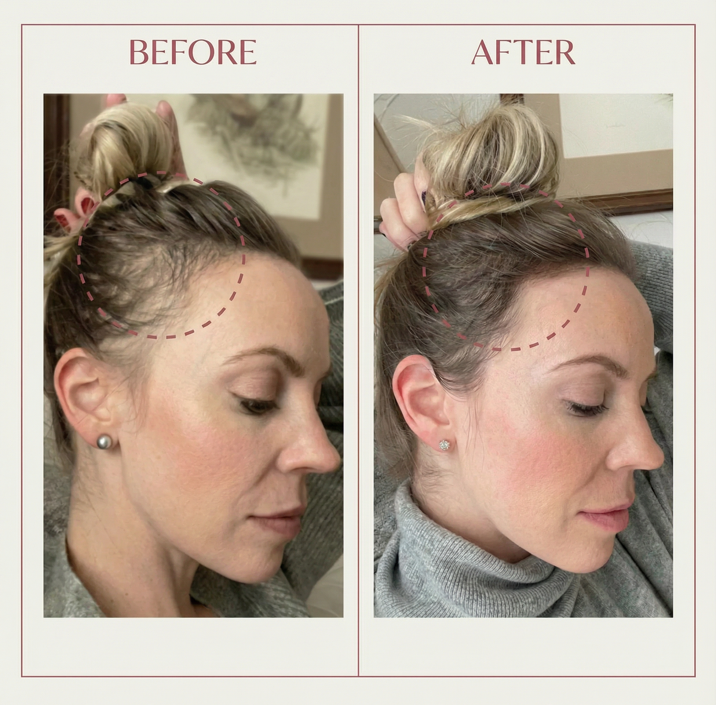 Valeriz™ Hair Growth & Scalp Massager